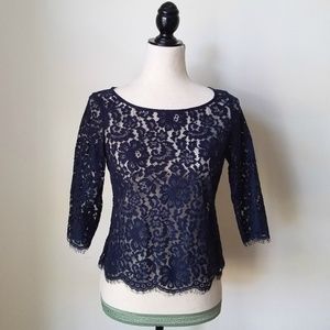 C. Wonder Lace Overlay
